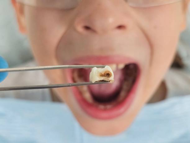 Best Affordable Emergency Dental Care  in Seymour, TX